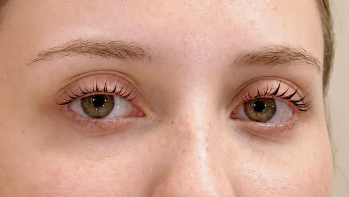 Eyelash